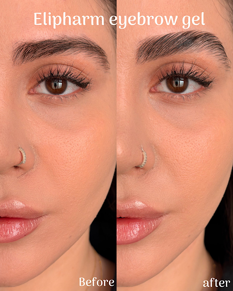قبل و بعد از ژل لیفت ابروی تقویتی الیفارم ☺️